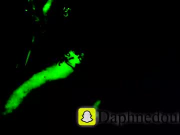 Daphnedixon June 28, 2025